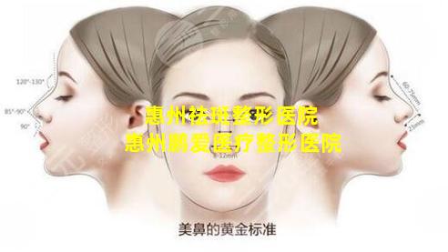惠州祛斑整形医院 惠州鹏爱医疗整形医院